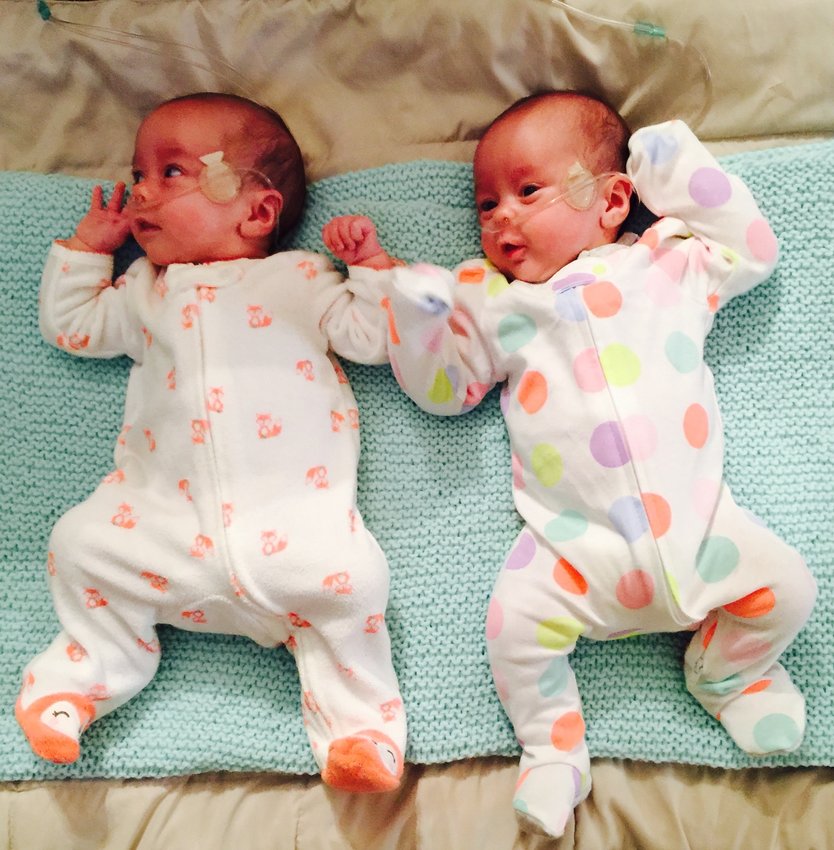 Zoey, left, and Kenna Conley soon after they were born.